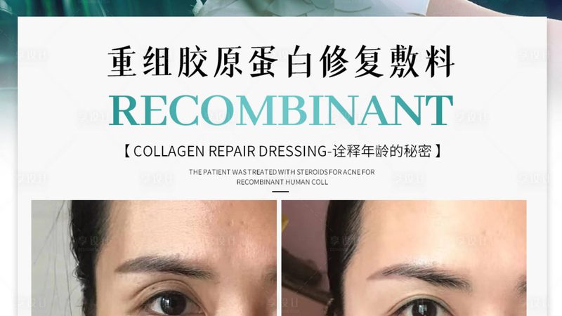 隆鼻假体取出，费用揭秘与关键因素