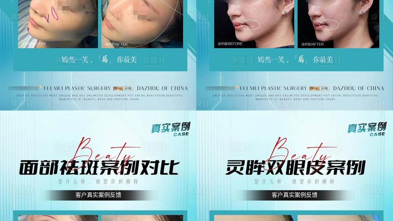 国产水光针和进口水光针对比哪个好