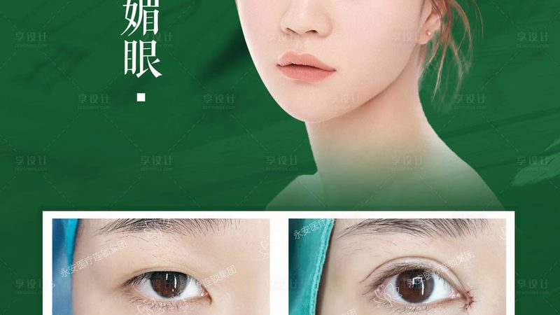 上海轻医美仪器：揭秘轻医美设备背后的科技力量