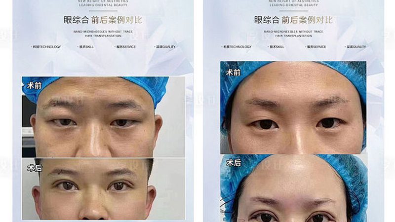 医美项目价格表揭秘：揭秘价格背后的秘密