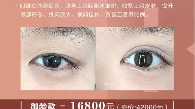 北京下颌角截骨失败修复，揭秘价格背后的真相