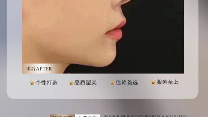 如何辨别整形美容医院靠谱性：揭秘关键要素