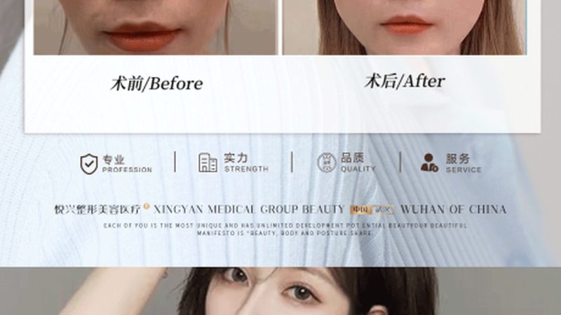 水光针能改善皮肤暗沉吗