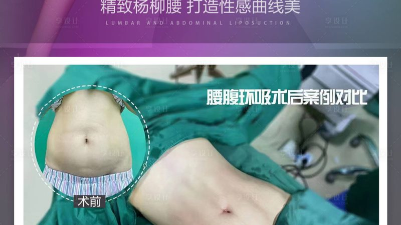 解读医美报价单：如何看清其中的“门道”**