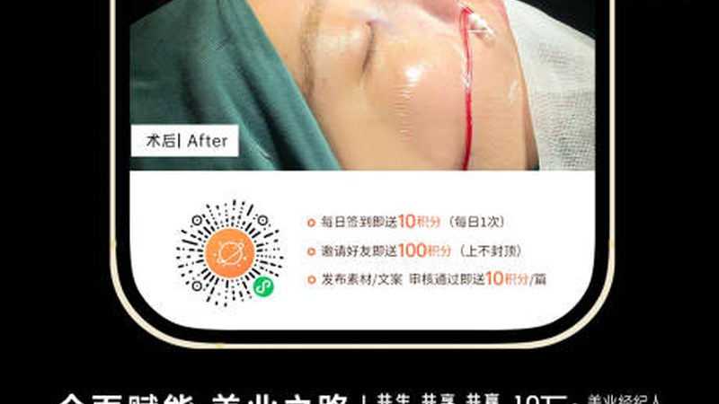 肉毒素注射瘦脸，揭秘专业流程与注意事项