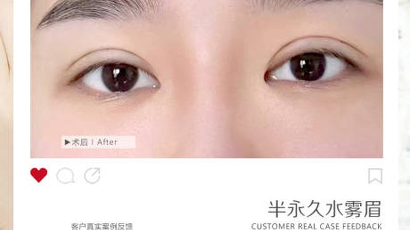 在选购皮肤管理仪器时，以下指标值得关注：
