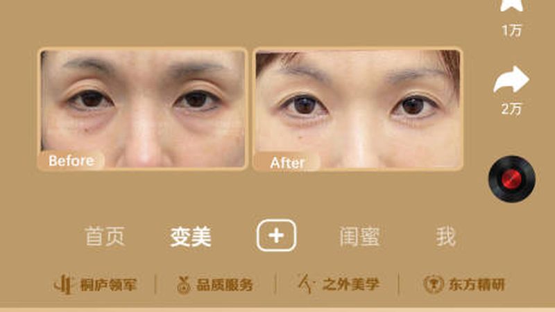广州注射美容材料批发市场：揭秘高品质美容材料的选购之道**