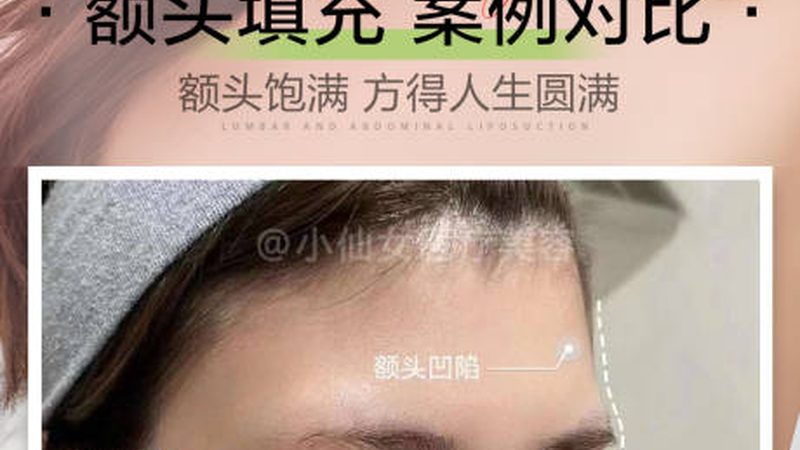 超声炮：揭秘其价格构成与影响因素**